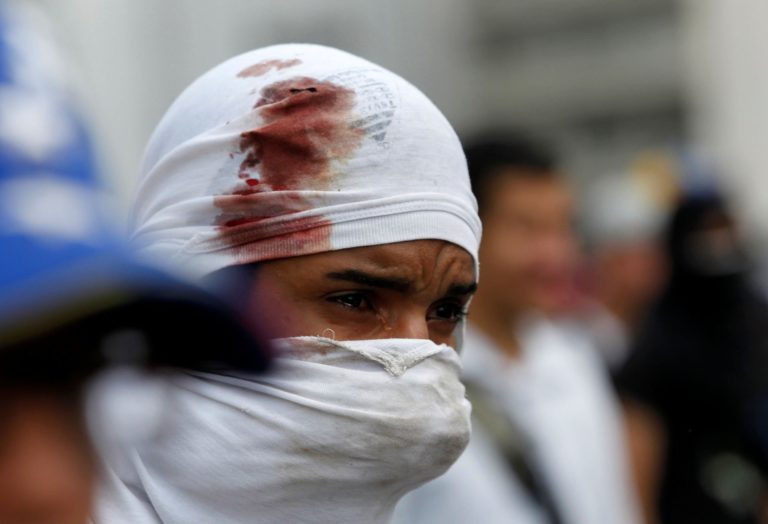 La resistencia en Venezuela – Imagenes