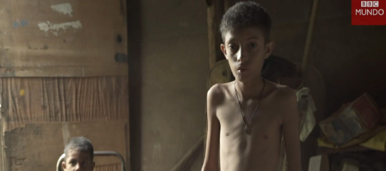 BBC MUNDO: La dramática desnutrición infantil en Venezuela